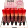 Labial Hyaluronic Acid